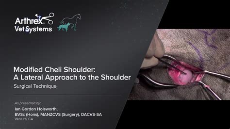 Arthrex Modified Cheli Shoulder A Lateral Approach To The Shoulder