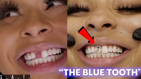 Chrisean Rocks New Blueface Tooth Is Going Viral The Blue Tooth
