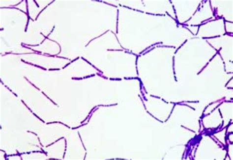 Bacillus Subtilis Morphology And Gram Stain