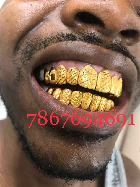 $79 for one led light teeth whitening treatment at vita body club ($249 value). Gold teeth - grillz for Sale in Miami, FL - OfferUp