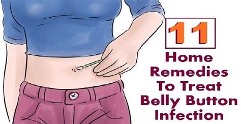 11 Effective Home Remedies To Treat Belly Button Infection Home