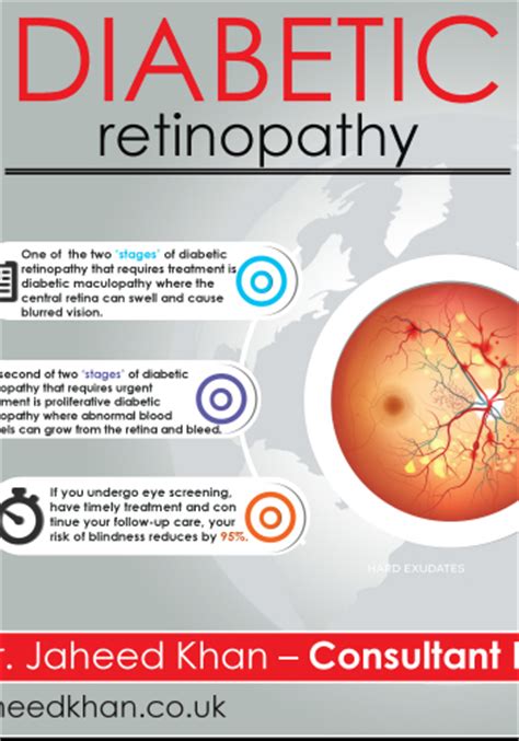 Eye Health Infographic Downloads Jaheed Khan