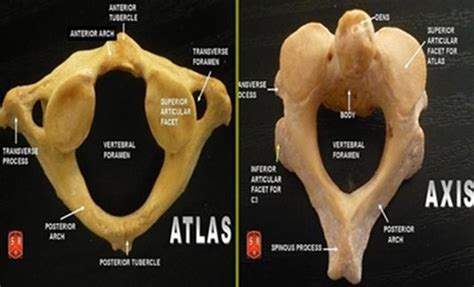 Atlas Vs Axis Bone Anatomical Teaching Models Plastic Vertebrae Model
