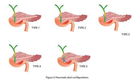 Pancreatic Duct Anatomy