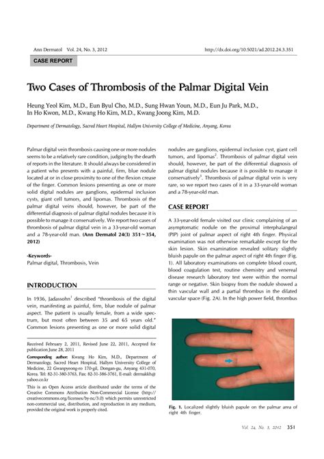 Palmar Digital Vein Thrombosis Renew Physical Therapy