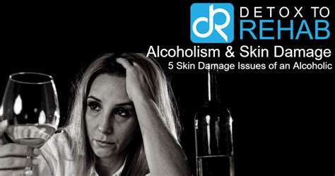 Skin Damage And Alcoholism Detox To Rehab