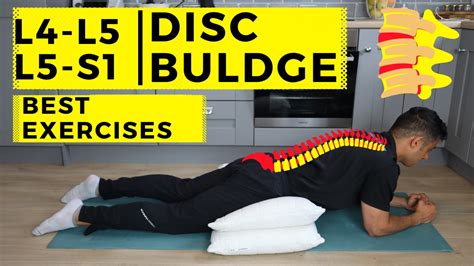 Herniated Disc Treatment Exercises Herniated Disc In Neck Exercises