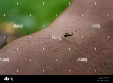 Midge Bite High Resolution Stock Photography And Images Alamy