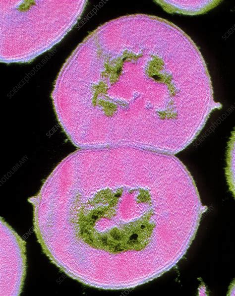 Fcol Tem Of Streptococcus Viridans Stock Image B2360038 Science