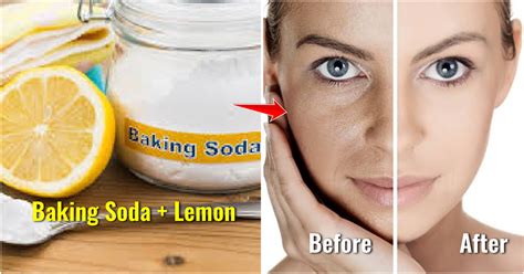 Beauty Benefits Of Baking Soda