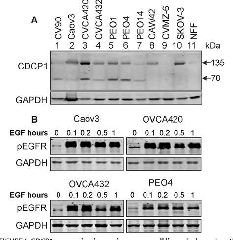 Figure From The Cell Surface Glycoprotein Cub Domain Containing