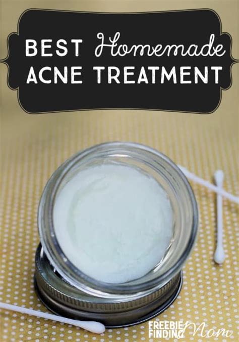 Best Homemade Acne Treatment