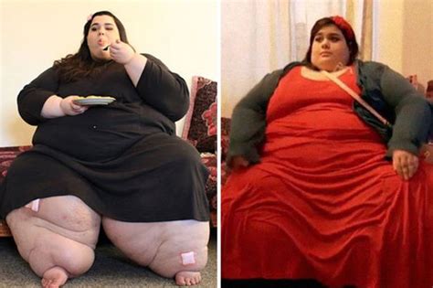 Most Dramatic Weight Loss Transformations Ever You Wont Believe What