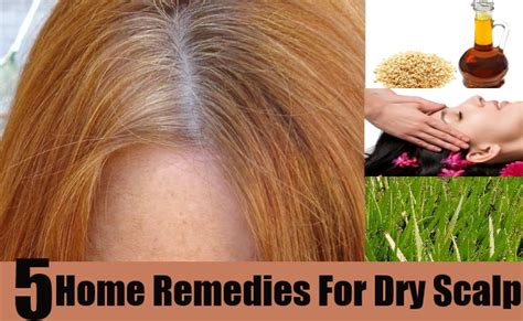 5 Effective Home Remedies For Dry Scalp Natural Home Remedies