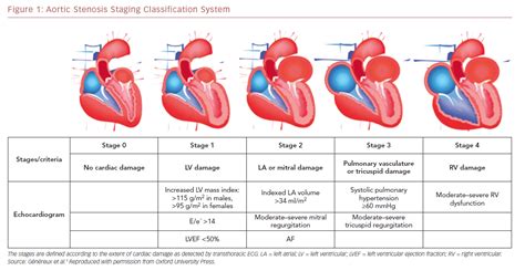 Aortic Stenosis Staging Classification System Radcliffe Cardiology