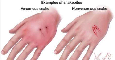 A Definitive Guide To Deadly And Non Deadly Snakes Ftw Gallery