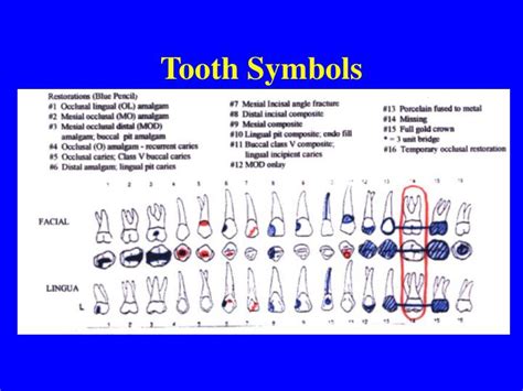 PPT - Dental Charting PowerPoint Presentation - ID:1282644