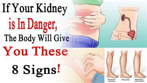 Can Back Pain Mean Kidney Problems