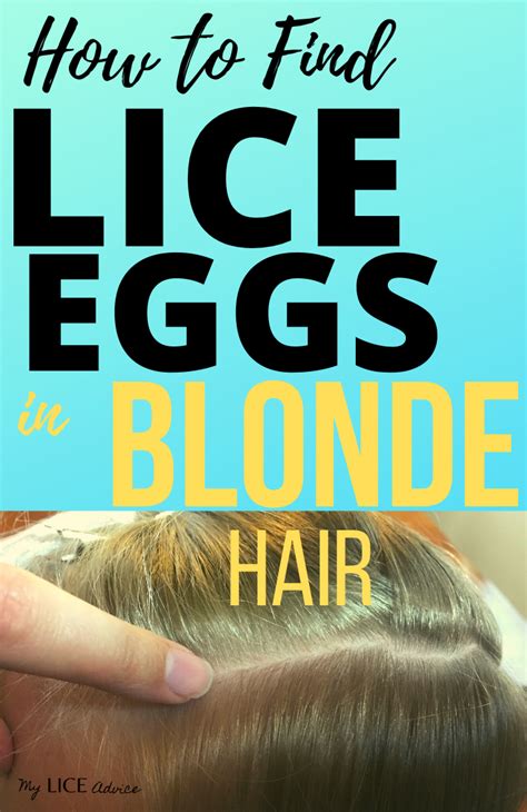 Top More Than 67 Lice In Blonde Hair Best Ineteachers
