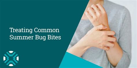Treating Common Summer Bug Bites Urgent Care Near Me