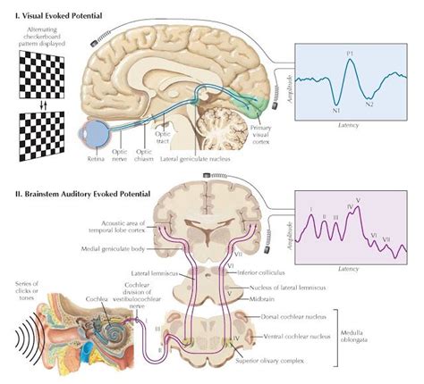 Visual And Auditory Evoked Potentials Brain Anatomy Nervous System