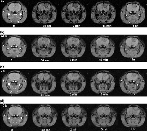 Gradient Echo Mri Of The Rat Brain Containing A 9l Glioma At 0 30