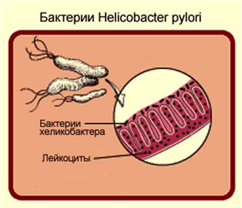 Диета после лечения хеликобактер пилори