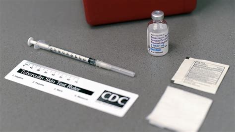 Rite Aid Tb Test