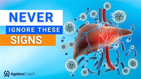 12 Early Signs Of Liver Cirrhosis Is Your Liver Safe Youtube
