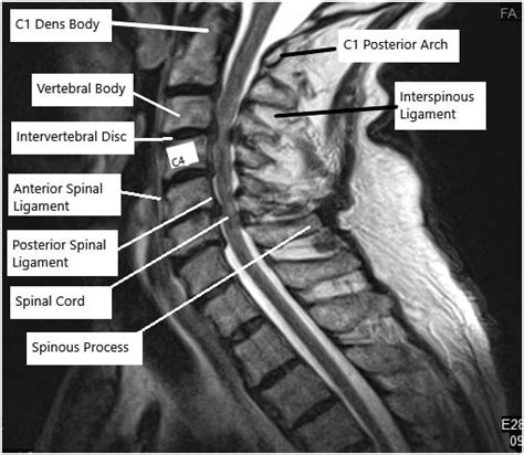 Cervical Spine