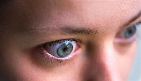 Know The Symptoms That Can Signal Graves ﻿eye Disease