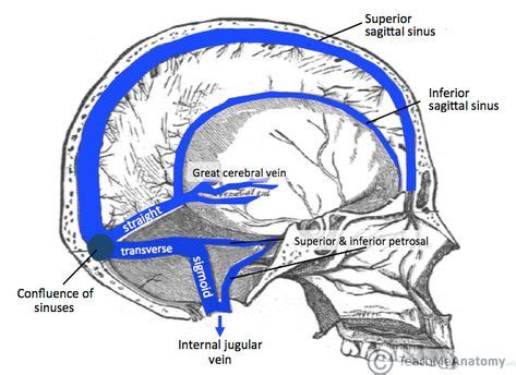 Cerebral Venous Sinus Thrombosis CVST Neurological Disorder