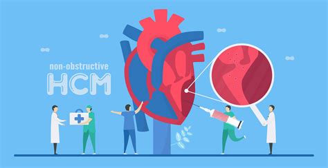 Cardiology Hcm Concept 965519 Vector Art At Vecteezy