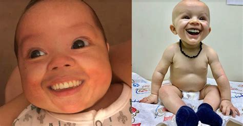 Babies With Adult Teeth Look Terrifying Vlrengbr
