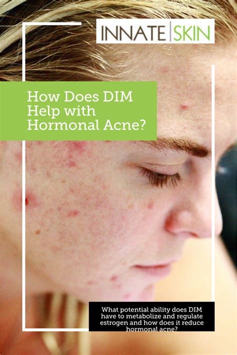 Dim Diindolylmethane And Hormonal Acne In 2020 Hormonal Acne Acne