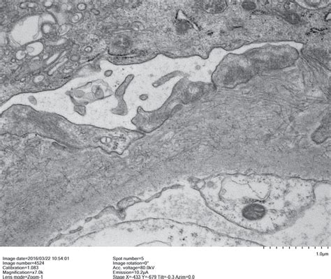 Transmission Electron Microscopy Of Glomerular Basement Membrane With