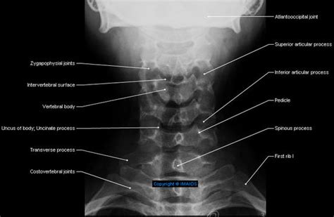 Radiographic Positioning Cervical X Ray