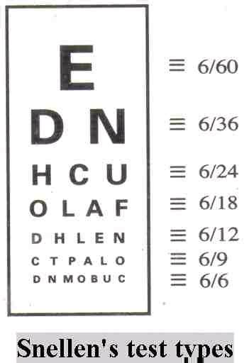 Clear Your Doubts About Eye Vision Standards For Railway Exams