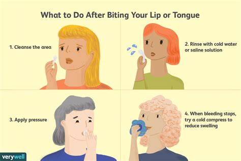 Was tun wenn Sie auf Lippe oder Zunge beißen