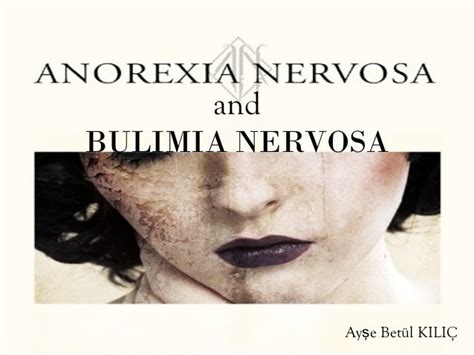 Recovering Anorexia Nervosa And Bulimia Nervosa New Movies This Week