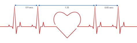 Hrv What Is It And Why Does It Matter Pastfiftyfitness