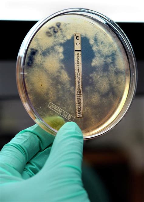 Fungal Meningitis Research Photograph By Cdcscience Photo Library