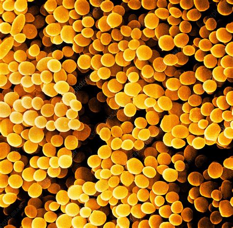 Staphylococcus Aureus SEM Stock Image C Science Photo