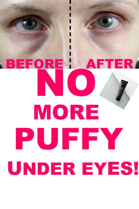 Get Rid Of Puffy Under Eyes Anne P Makeup And More