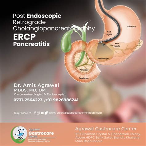 Post Endoscopic Retrograde Cholangiopancreatography ERCP Pancreatitis