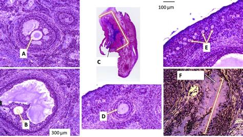 Solved View The Figure Below Showing Microscopic Cross Section Slides