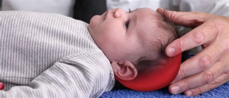 Baby Flat Head Syndrome What Causes Plagiocephaly Or Brachycephaly