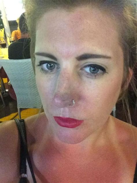 Mum Claims Botched Lip Fillers Left Her Looking Like A Duck Yorkshirelive