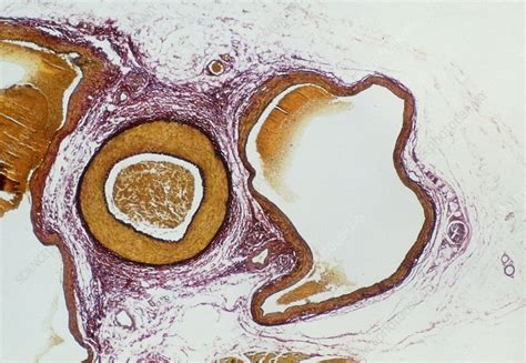 Lm Of A Cross Section Through An Artery And Vein Stock Image P206