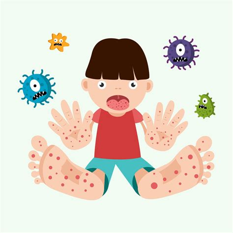 Hand Foot Mouth Disease Concept Child Infected Enterovirus Vector